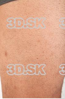 Skin texture of Waldo 0002